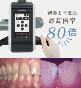 細部まで把握最高倍率80倍